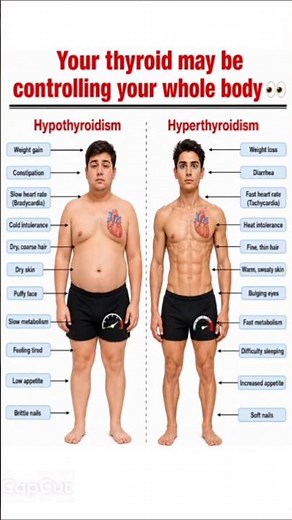 ⚠️ Hypothyroidism vs Hyperthyroidism: Don’t Miss These Signs! 😳🔥 #healthawareness #viral #thyroid