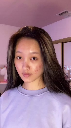 Nya Anya ✊🏻😽✊🏻. Who took my ears? #fyp #sian #nya