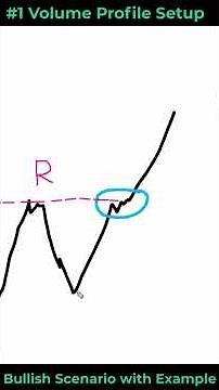 The Easiest Volume Profile Structure You’re Ignoring (Explained with Example)