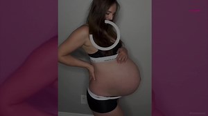 77K views · 396 reactions | Une maman partage tout son accouchement...