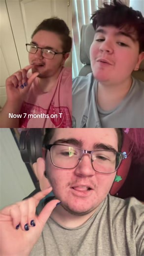 #duet with @DD #greenscreen 1year and 8 months on T the beard is before I shaved recently I definitely plan to grow it back when my acne is under control