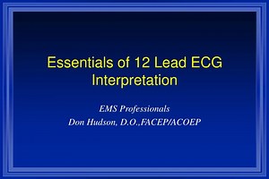 Essentials of 12 Lead ECG Interpretation - SlideServe