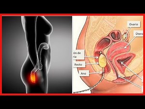 What is proctitis, what causes it, and how is it treated?