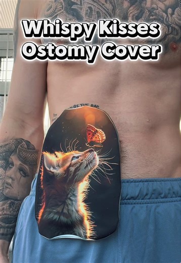 Express Your Style with Adorable Stoma Bags