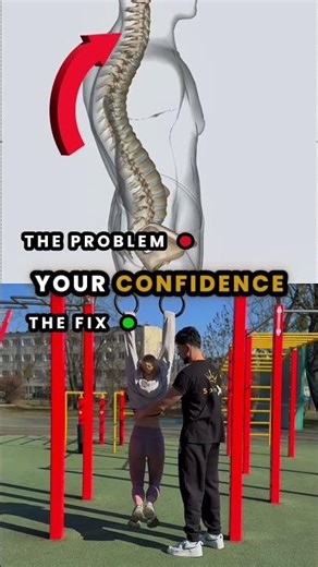 How to Fix Your Neck Hump & Improve Posture Fast