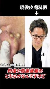What do you think of this cyst removal method? A dermatologist explains #shorts