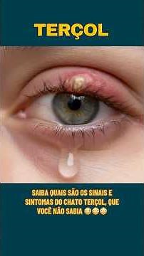 TERÇOL E OS SINAIS