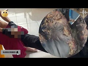 ⚡ Shocking Jigger Cluster – Dry Cracks Split Open to Expose Nests! #NT227