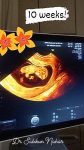 157K views · 1.4K reactions | Pregnancy with SLE | Dr. Sabikun Nahar | Facebook