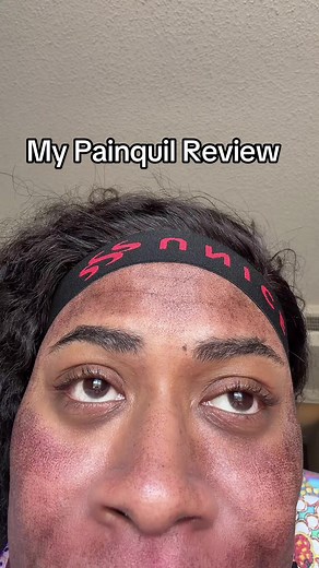 Understanding My Painquil Experience for Skin Treatments