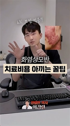 화염상모반 치료비용 아끼는 꿀팁