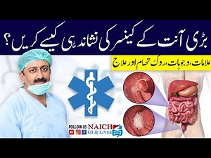 Treatment of Large Intestine Cancer | Colorectal Cancer | Blood in Stool – Symptom of Colon Cancer