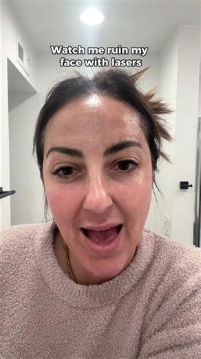 This is what melasma and pigmentation looked like on my skin.