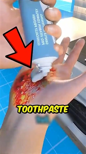 If You Ever Burn Yourself While Cooking, Do This Immediately!