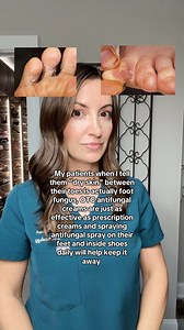 19K views · 56 reactions | Have you checked between your toes lately? See the peeling skin? If so, it might be fungus!  Great news: it can be cleared with OTC lamisl cream! Also pick up some antifugal spray to spray inside your shoes periodically to keep the fungus away. Drop your skincare questions below ⬇️ #lamisil #fungus #feet #skincare #dermtips #dermatologist #draleksandrabrown | Dr. Aleksandra Brown, DO, FAOCD, FAAD | Facebook
