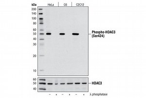 HDAC3 - Alchetron, The Free Social Encyclopedia