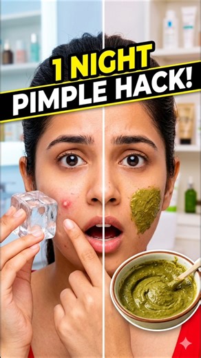 Sudden Pimple? Try This Ice + Neem Trick | Instant Pimple Remedy