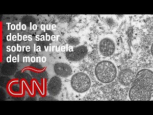 Viruela del mono: ¿cómo se propaga, cuáles son sus síntomas y por qué este brote es diferente?