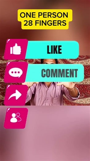 This Person Was Born with 28 FINGERS 😱 #didyouknow #facts #trending