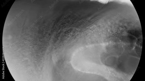 contraction and heartbeat of the cochlea embryo, under a microscope Stock Video