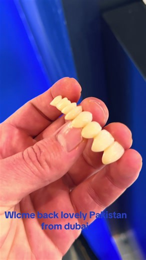 Welcome Back to Pakistan from Dubai: A Heartfelt Reunion