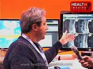 Key Features of Merge's PACS by Health Imaging Hub