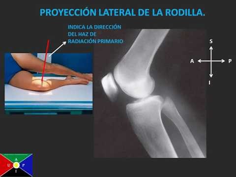 Anatomía de la rodilla en radiología convencional