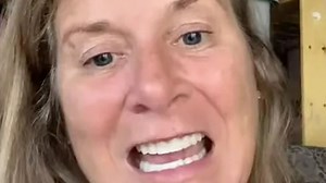 Turkey teeth left me in debt - but I can claim some cash back from the taxpayer