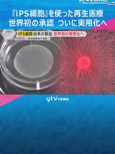心臓病やパーキンソン病を治療するためのiPS細胞を使った製品が世界で初めての実用化へ動き出しました。19日、厚生労働省の専門部会で条件付きで製造・販売が承認され、iPSの再生医療が大きく前進しました。#tiktokでニュース #読売テレビニュース