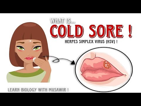 Cold sores or Fever blisters - Small painful blisters on lips ! #herpes #blisters