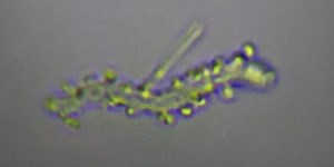 Nanoworms, Synthetic Parasites and... Creatures from the Twilight Zone? - Part 2