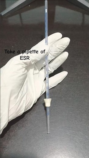 ESR Test (Erythrocyte Sedimentation Rate) Method : Westergren Manual #lab #dmlt #esr #labtechnician