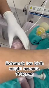 Extremely low birth weight neonate 900gram🙄🙄🙄 #ankur maitrika hospital 🏥 #newbornbaby #cutebaby #baby | Babies videos
