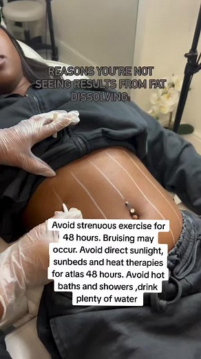 Lipo Shorts Injection: Client Body Transformation