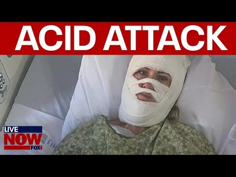 Savannah acid attack: Woman severely burned in "unprovoked attack"