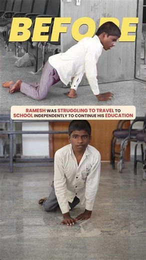 A Wheelchair Changed Ramesh's Future | Empowering Education Through Assistive Devices