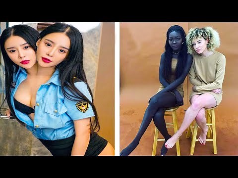 20 Most Unique Unusual Twins You Won't Believe Exist