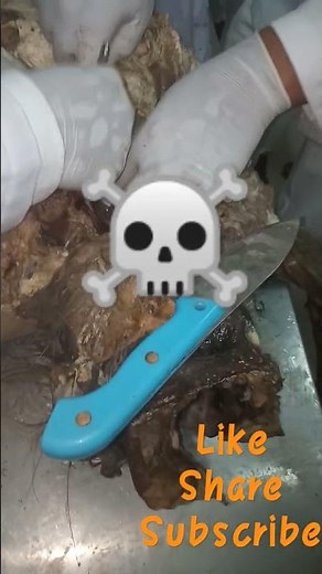 dissection #medicalstudent #learning