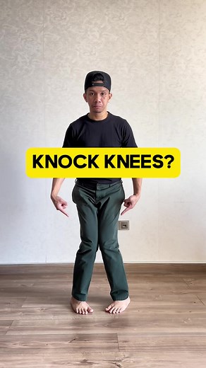 Correcting Knock Knees Naturally with Internal Rotation Knee Stretches
