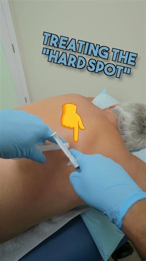 Precision Care Medical&Sports Performance on Instagram: "Trigger point injections can help relieve stubborn back pain caused by tight muscles and knots. This quick treatment targets the exact source of pain, allowing you to move better, feel better, and finally make real progress with physical therapy. #painmanagement #painmanagement #backpain"