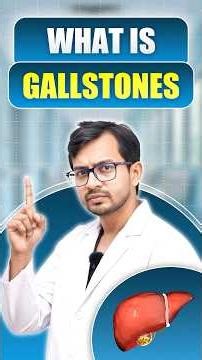 What are Gallstones? | #trending #shorts #gastroenterologist #gallstone