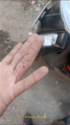 Day 3 pr toh bura hogyaa 🙂 | dropout to tech Job |@Anshuplays-370