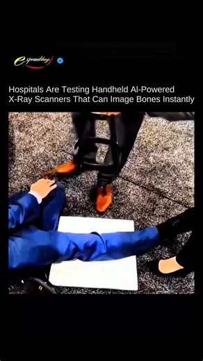 This Handheld AI X-Ray Scanner Images Bones Instantly Without Traditional X-Ray Rooms Hospitals and emergency clinics are beginning to test handheld Al-powered X-ray scanners that can image bones instantly without using traditional X-ray rooms. Instead of moving patients to shielded radiology areas, this portable device scans limbs directly at the bedside or on-site. Using low-dose X-ray imaging combined with Al-based reconstruction software, the system produces clear bone images in seconds on a