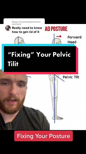 Reply to @bryanstaysblocked Making Changes In Your Posture Or “Fixing it” Can Be Really Tough. Our body naturally likes certain positions due to efficiency. So you can train yourself to not be in pelvic Tilit, but it will take a lot of awareness and work ✊ @peakpursuitrehab