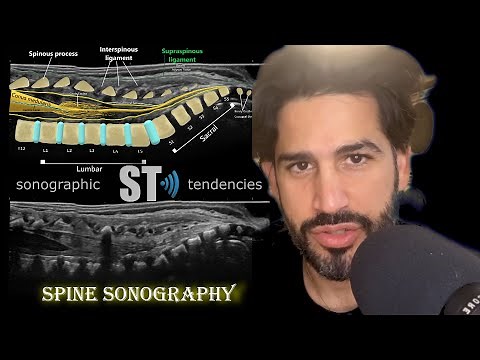 Spine Ultrasound Protocol