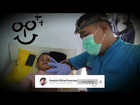 Sunat Modern Anak Smp