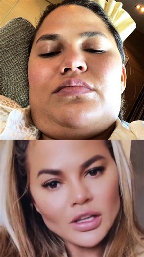 Chrissy Teigen Is Unrecognizable in New Photos—Is Ozempic to Blame? #ChrissyTeigen #ozempic | Beyond The Screen