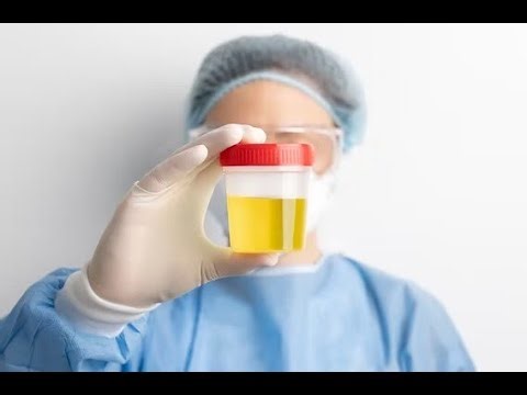 Albuminuria, Low molecular or High molecular weight Proteinuria