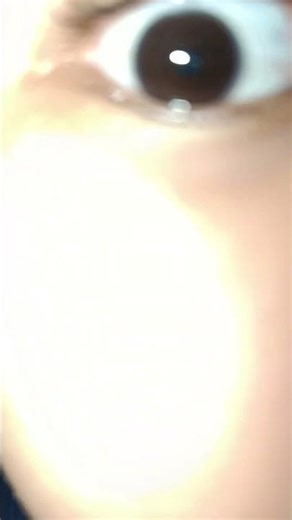 My real eye color black like obsidian