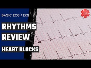 Basic ECG/ EKG Part 5: Heart Blocks
